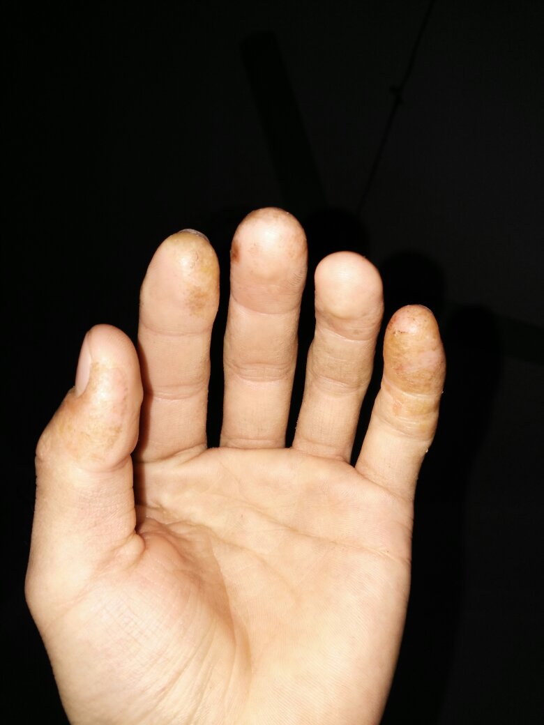 梦境侦探无线耳机在哪里 梦境侦探无线耳机位置详解|beat365官网中文(图3)